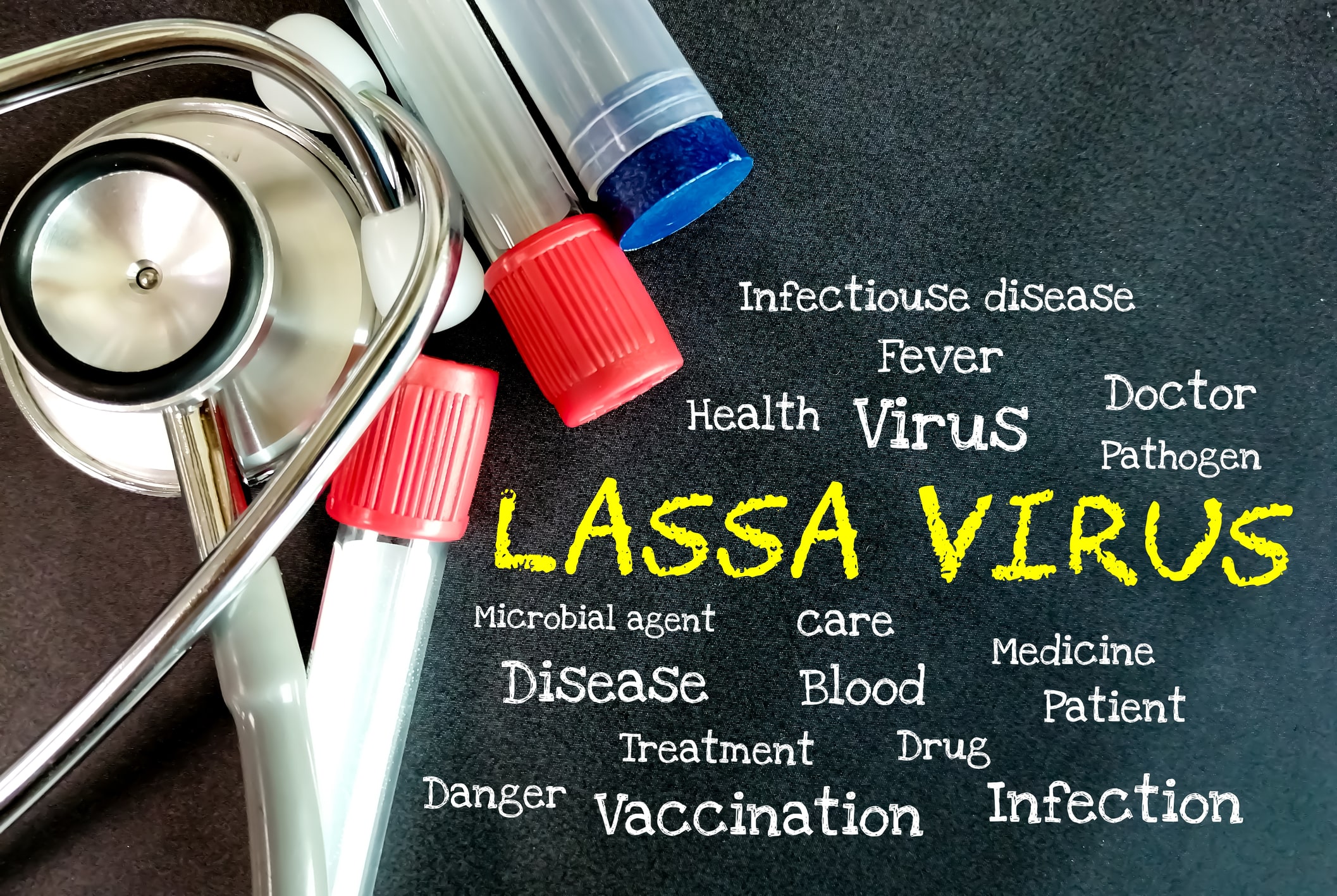 Fièvre de Lassa : un premier cas confirmé en France
