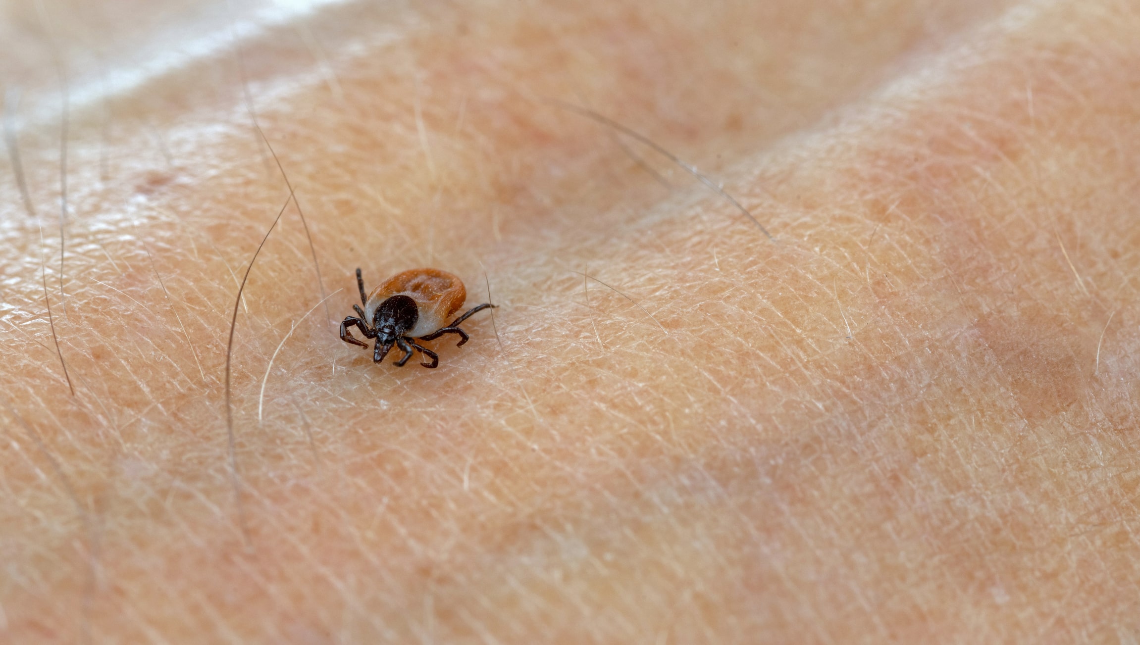 Des bactéries inédites véhiculées par les tiques : un danger insoupçonné pour l’homme